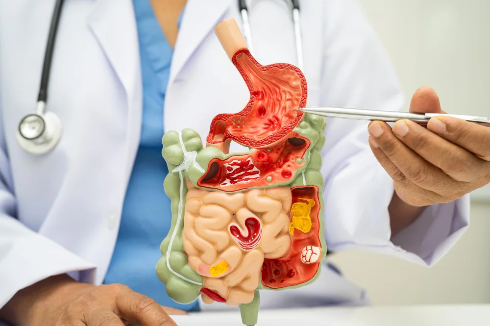 Tratamiento de hemorragia gastrointestinal: Atención especializada para controlar el sangrado digestivo